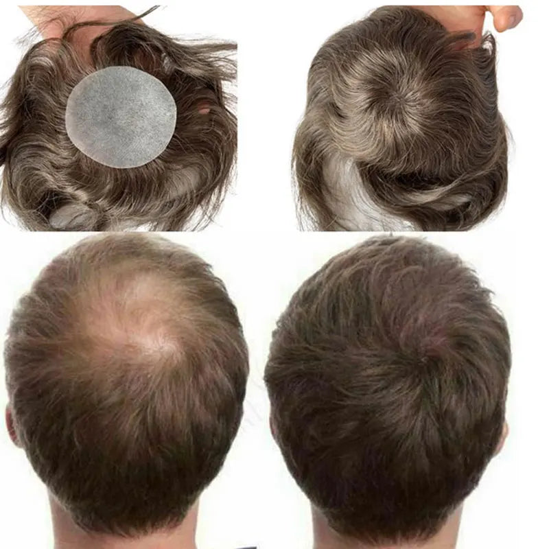 European Human Hair Men's Wigs Full Skin PU Bald Spot Patches Toupee For Men and Women 8cm X 8cm Hair Piece  Glue On Hair System